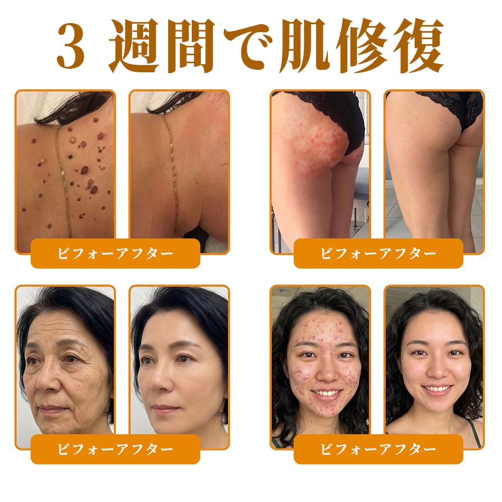🎁残りわずか5点！カートに追加して70％OFF！