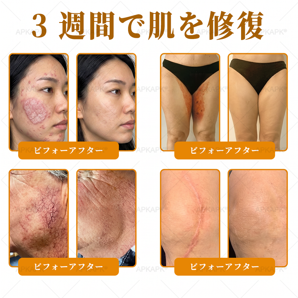 🎁残りわずか5点！カートに追加して70％OFF！