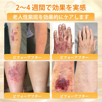🎁残りわずか5点！カートに追加して70％OFF！
