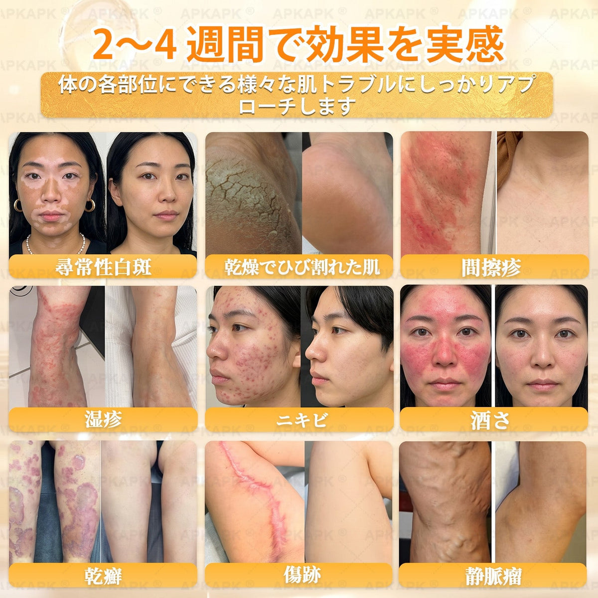 🎁残りわずか5点！カートに追加して70％OFF！