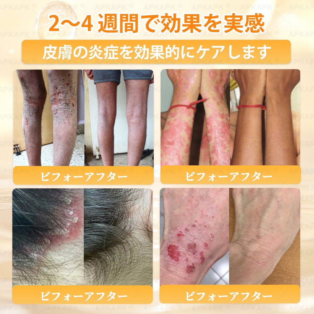 🎁残りわずか5点！カートに追加して70％OFF！